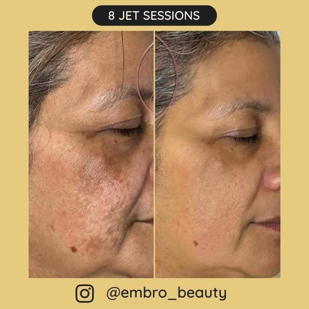 Before after sessions 5 1024x1024