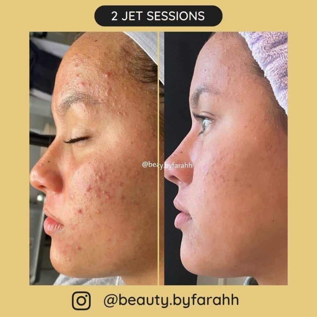Before after sessions 8 1024x1024