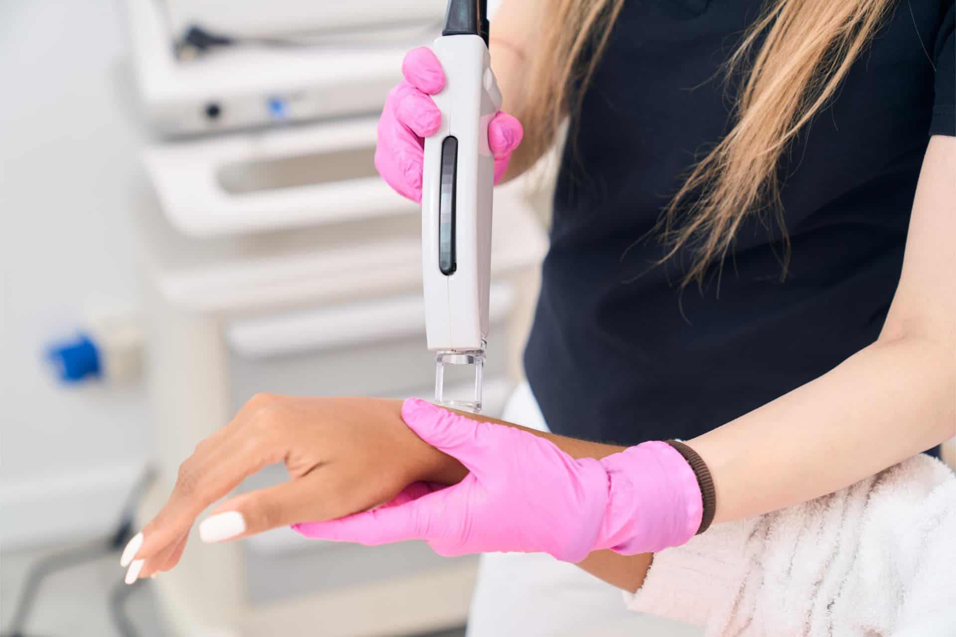 Laser epilation of hands in a modern center of aes 2026 03 19 23 28 05 utc